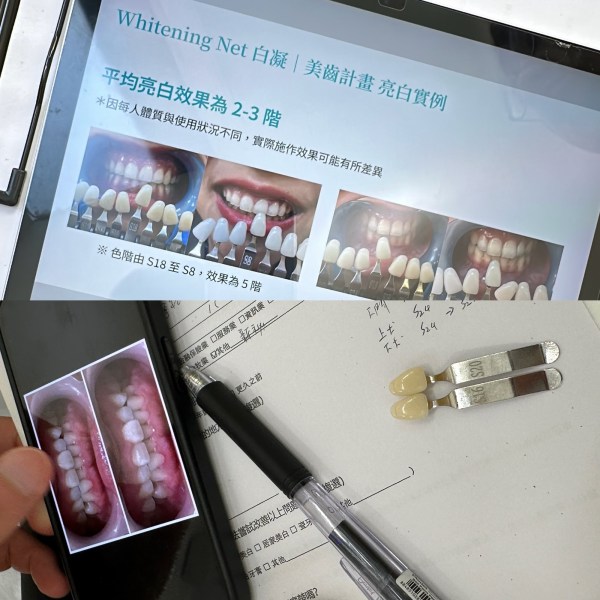 台北師大牙齒淨白推薦-白凝店內環境、溫和牙齒淨白過程-照光儀器